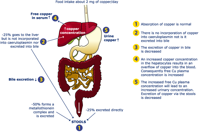Diagram II: Wilson's disease patients before treatment: reduced excretion and retention of copper
