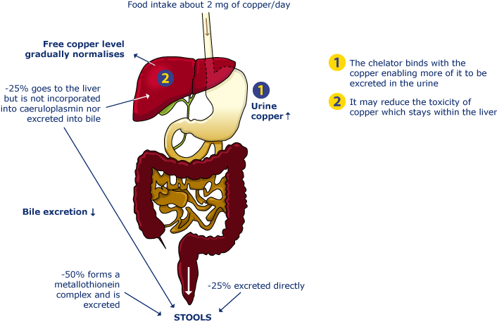 Diagram IV: Wilson's disease patients on chelator therapy: enhanced urinary excretion of copper